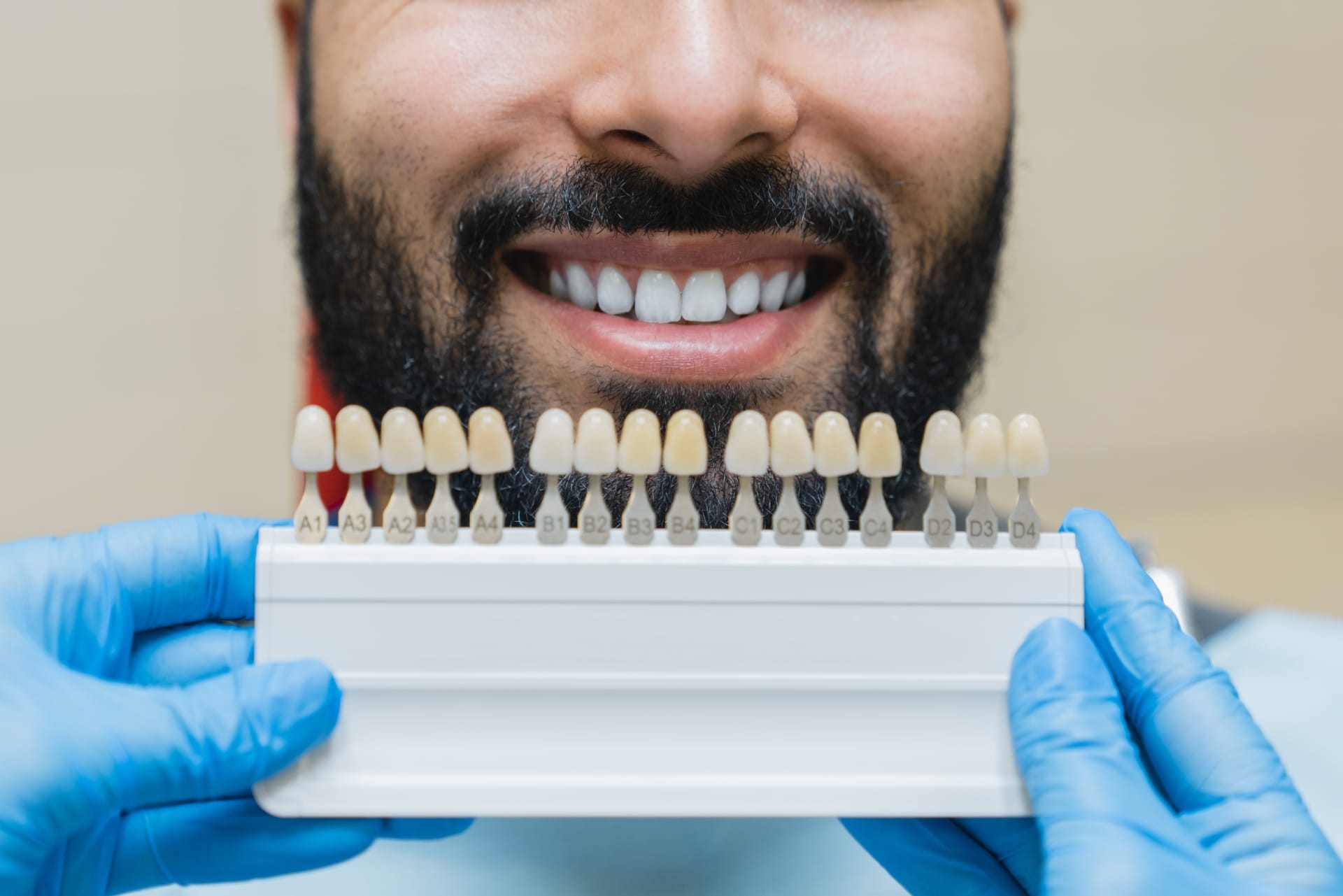 teeth whitening in New Lynn